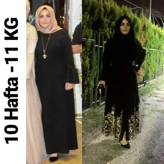 Uzm. Dyt. Dilara Turan Karayel profilinde yer alan galeri fotoğrafı.