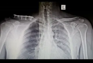 Op. Dr. Mehmet Hakan Yılmaz profilinde yer alan galeri fotoğrafı.