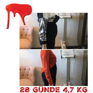 Dyt. Rabia Derya Bağcı profilinde yer alan galeri fotoğrafı.