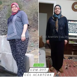 Dyt. Gül Acartürk profilinde yer alan galeri fotoğrafı.