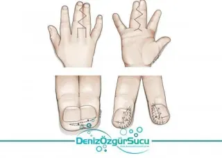 Op. Dr. Deniz Özgür Sucu profilinde yer alan galeri fotoğrafı.