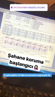 Dyt. Aybüke Subaşıoğlu Yeşilyurt profilinde yer alan galeri fotoğrafı.