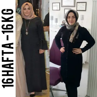 Uzm. Dyt. Dilara Turan Karayel profilinde yer alan galeri fotoğrafı.