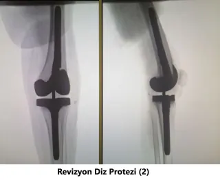 Op. Dr. Javid M. Azarabadı profilinde yer alan galeri fotoğrafı.