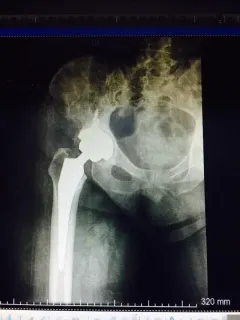 Op. Dr. Mehmet Hakan Yılmaz profilinde yer alan galeri fotoğrafı.