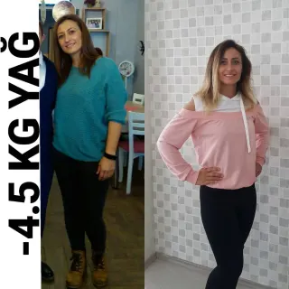 Uzm. Dyt. Dilara Turan Karayel profilinde yer alan galeri fotoğrafı.