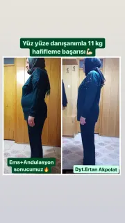 Dyt. Ertan Akpolat profilinde yer alan galeri fotoğrafı.
