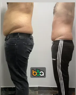 Dyt. Baran Özgür Avcı profilinde yer alan galeri fotoğrafı.