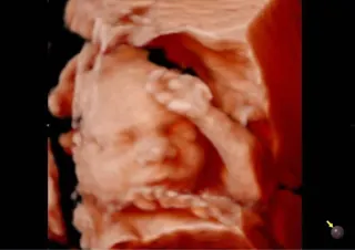 Op. Dr. Yasemin Ağralı profilinde yer alan galeri fotoğrafı.