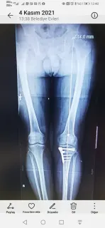 Prof. Dr. Ümit Tuhanioğlu profilinde yer alan galeri fotoğrafı.
