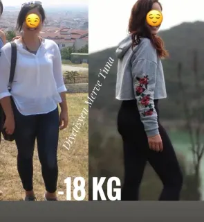 Dyt. Merve Tuna profilinde yer alan galeri fotoğrafı.