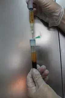 Op. Dr. Mehmet Hakan Yılmaz profilinde yer alan galeri fotoğrafı.