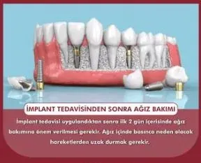 Dt. Ali Osman Emiroğlu profilinde yer alan galeri fotoğrafı.