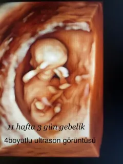 Op. Dr. Dilek Turğut Kestane profilinde yer alan galeri fotoğrafı.