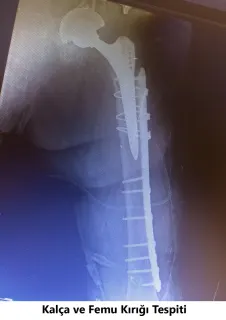 Op. Dr. Javid M. Azarabadı profilinde yer alan galeri fotoğrafı.