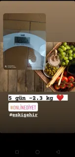 Dyt. Elif Seçgin profilinde yer alan galeri fotoğrafı.