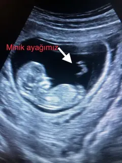 Op. Dr. Dilek Turğut Kestane profilinde yer alan galeri fotoğrafı.
