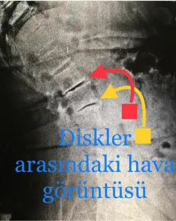Doç. Dr. Veysel Antar profilinde yer alan galeri fotoğrafı.