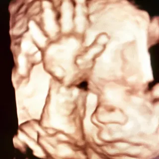 Op. Dr. Dilek Turğut Kestane profilinde yer alan galeri fotoğrafı.