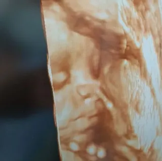 Op. Dr. Talha Ayvaz profilinde yer alan galeri fotoğrafı.