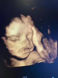 Op. Dr. Emine Suat profilinde yer alan galeri fotoğrafı.