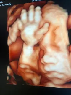 Op. Dr. Dilek Turğut Kestane profilinde yer alan galeri fotoğrafı.