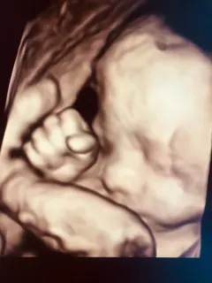 Op. Dr. Dilek Turğut Kestane profilinde yer alan galeri fotoğrafı.