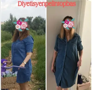 Uzm. Dyt. Pelin Topbaş profilinde yer alan galeri fotoğrafı.