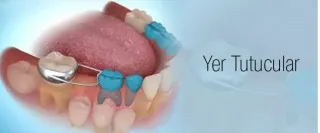 Dr. Dt. Neslihan Özyörük Yıldırım profilinde yer alan galeri fotoğrafı.