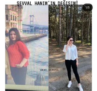 Dyt. Gül Acartürk profilinde yer alan galeri fotoğrafı.