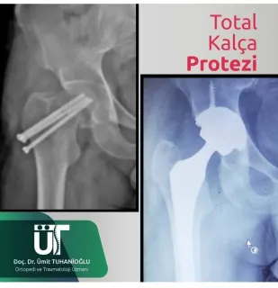 Prof. Dr. Ümit Tuhanioğlu profilinde yer alan galeri fotoğrafı.