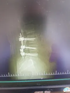 Op. Dr. Abdulsemat Gökalp profilinde yer alan galeri fotoğrafı.