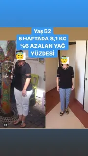 Dyt. Buse Akay Şen profilinde yer alan galeri fotoğrafı.