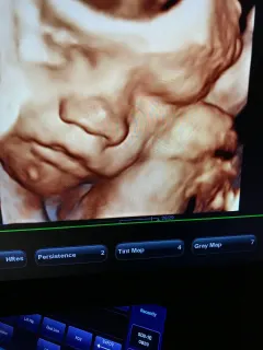 Uzm. Dr. Günnur Yüce profilinde yer alan galeri fotoğrafı.