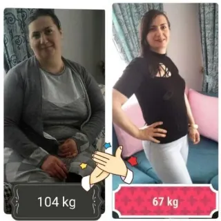 Dyt. Nermin Didem Bolat profilinde yer alan galeri fotoğrafı.