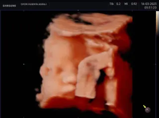 Op. Dr. Yasemin Ağralı profilinde yer alan galeri fotoğrafı.