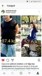 Dyt. Nermin Didem Bolat profilinde yer alan galeri fotoğrafı.