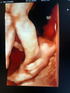 Op. Dr. Dilek Turğut Kestane profilinde yer alan galeri fotoğrafı.