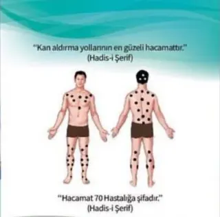 Dr. İlyas Yazıcı profilinde yer alan galeri fotoğrafı.