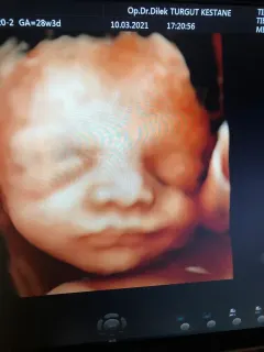Op. Dr. Dilek Turğut Kestane profilinde yer alan galeri fotoğrafı.