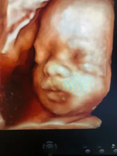 Op. Dr. Dilek Turğut Kestane profilinde yer alan galeri fotoğrafı.