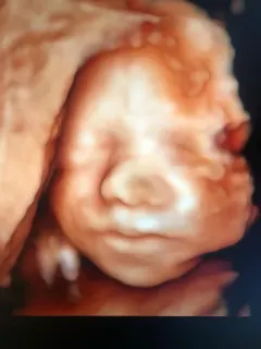 Op. Dr. Dilek Turğut Kestane profilinde yer alan galeri fotoğrafı.