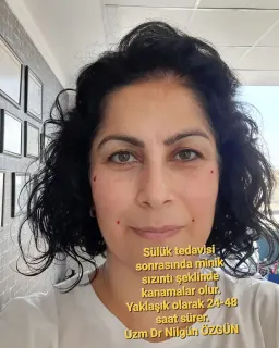 Uzm. Dr. Nilgün Özgün profilinde yer alan galeri fotoğrafı.