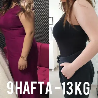Uzm. Dyt. Dilara Turan Karayel profilinde yer alan galeri fotoğrafı.