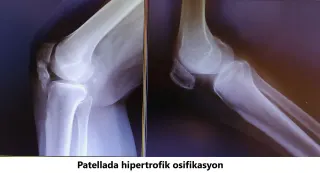 Op. Dr. Javid M. Azarabadı profilinde yer alan galeri fotoğrafı.
