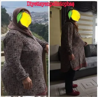 Uzm. Dyt. Pelin Topbaş profilinde yer alan galeri fotoğrafı.