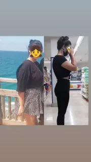 Dyt. Buse Akay Şen profilinde yer alan galeri fotoğrafı.