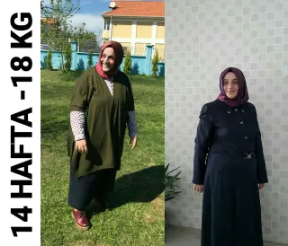 Uzm. Dyt. Dilara Turan Karayel profilinde yer alan galeri fotoğrafı.