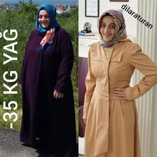 Uzm. Dyt. Dilara Turan Karayel profilinde yer alan galeri fotoğrafı.