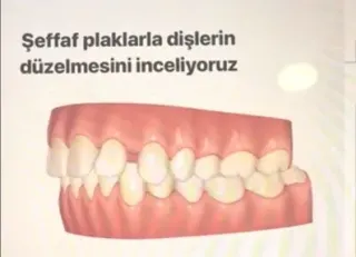 Dr. Dt. Derya Altekin profilinde yer alan galeri fotoğrafı.